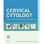 Cervical Cytology: Conventional and Liquid Based