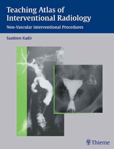 Interventional