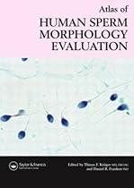 Atlas of Human Sperm Morphology Evaluation Atlas of Human Sperm Morphology Evaluation