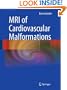 MRI of Cardiovascular Malformations