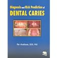 Diagnosis and Risk Prediction of Dental Caries, Volume 2 by Per Axelsson