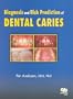Diagnosis and Risk Prediction of Dental Caries, Volume 2