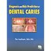 Diagnosis and Risk Prediction of Dental Caries, Volume 2