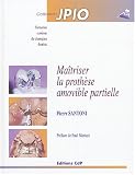 Ma�triser la proth�se amovible partielle