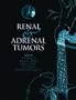 Renal and Adrenal Tumors: Biology and Management