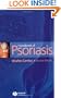 Handbook of Psoriasis