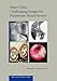 Mayo Clinic Challenging Images for Pulmonary Board Review (Mayo Clinic Scientific Press)