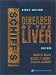 Books : Schiff's Diseases of the Liver: Edited by Eugene R. Schiff, Michael F. Sorrell, Willis C. Maddrey (2 Vol. Set)