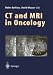 Book CT and MRI in Oncology