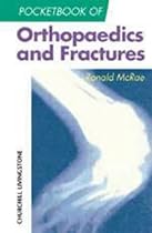 Pocketbook of Orthopaedics and Fractures, 1e (Churchill Pocketbooks) Pocketbook of Orthopaedics and Fractures, 1e (Churchill Pocketbooks)