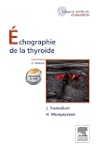�chographie de la thyro�de