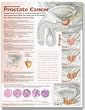 The Prostate Anatomical Chart