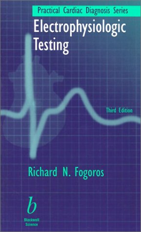 electrophysiologic testing