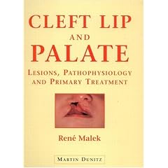 Cleft Lip and Palate by René Malek