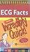 ECG Facts Made Incredibly Quick! (Incredibly Easy! Series)