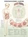 Understanding Cancer Anatomical Chart