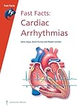 Cardiac arrhythmias