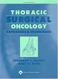 Thoracic Surgical Oncology: Exposures and Techniques