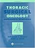 Thoracic Surgical Oncology: Exposures and Techniques