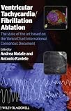 Ventricular Tachycardia / Fibrillation Ablation: The state of the Art based on the VeniceChart International Consensus Document