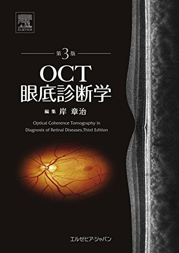 OCT眼底診断学　第3版 (Japanese Edition)