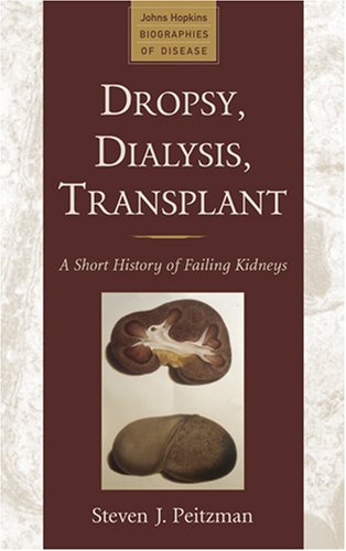 dropsy dialysis transplant a short history of failing kidneys johns hopkins biographies of disease
