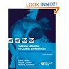 Catheter Ablation of Cardiac Arrhythmias: Basic Concepts and Clinical Applications