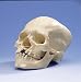 Skull with Cleft Jaw and Plate