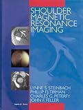 Shoulder Magnetic Resonance Imaging