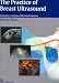 Book The Practice of Breast Ultrasound: Techniques, Findings, Differential Diagnosis