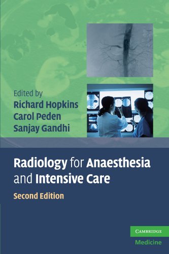 Radiology for Anaesthesia and Intensive Care (Cambridge Medicine (Paperback))