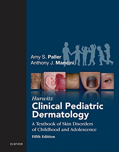 Hurwitz Clinical Pediatric Dermatology: A Textbook of Skin Disorders of Childhood and Adolescence