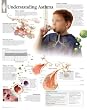 Laminated Understanding Asthma Educational Chart Poster - 56x71 cm