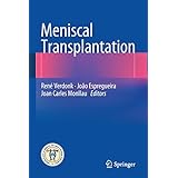 meniscal transplantation