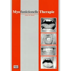 Myofunktionelle Therapie (Taschenbuch)