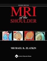 MRI of the Shoulder