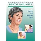 Dental Implants by 
