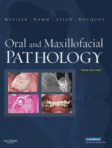 City Travel Guides Discounted  Books : Oral and Maxillofacial Pathology