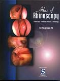 Atlas of Rhinoscopy