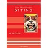 Dog Aggression:  Biting
