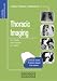 Books : Self-assessment Colour Review of Thoracic Imaging