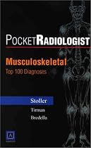 PocketRadiologist - Musculoskeletal: Top 100 Diagnoses