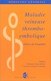 Maladie veineuse thrombo-embolique