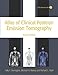 Atlas of Clinical Positron Emission Tomography: Includes interactive DVD-ROM (Hodder Arnold Publication)