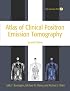 Atlas of Clinical Positron Emission Tomography: Includes interactive DVD-ROM (Hodder Arnold Publication)