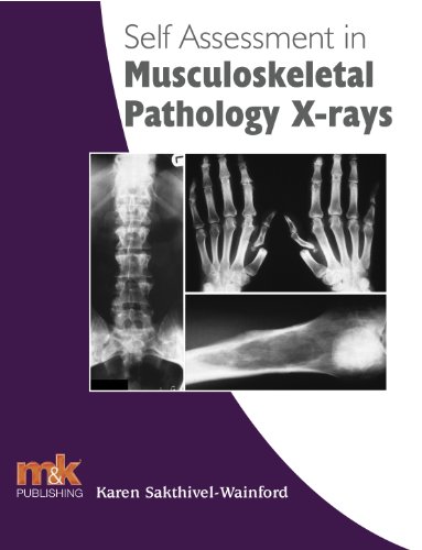 Self Assessment in Musculoskeletal Pathology X-rays (Self-assessment in X-ray Interpretation)