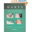 Warts: Diagnosis and Management: An Evidence-based Approach