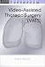 Search : Video-Assisted Thoracic Surgery (Vademecum)