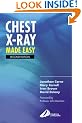 Chest X-Ray Made Easy
