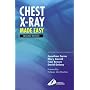 Chest X-Ray Made Easy